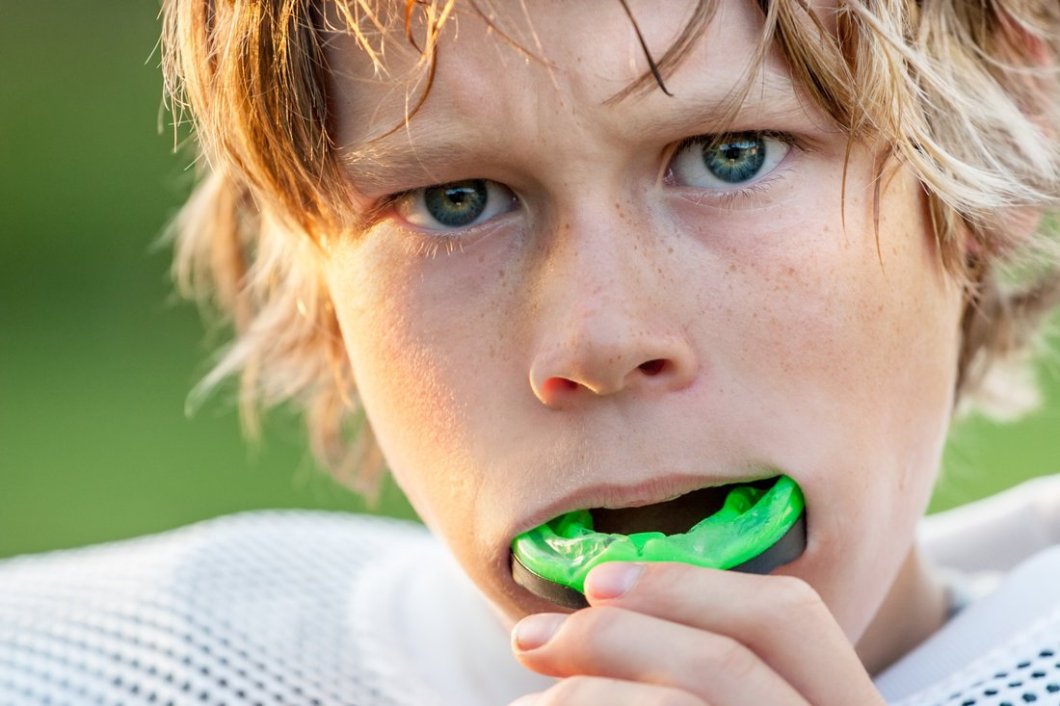 sports-mouth-guard