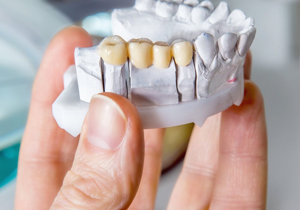 Technical shots of model on a dental prothetic laboratory.Dentist hand with plaster model